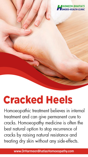 homeo medicine for cracked heels