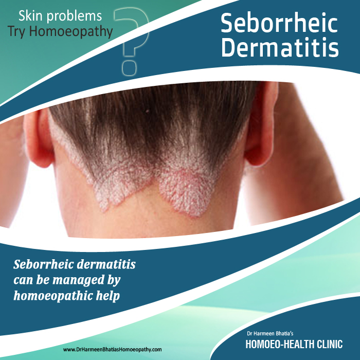 Seborrheic dermatitis3.1