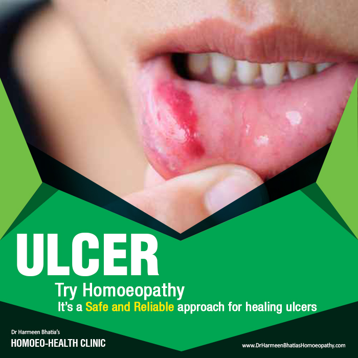 ulcer