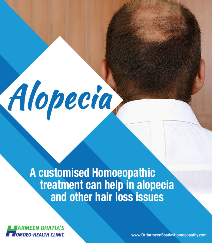 Alopecia