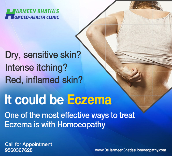 Eczema