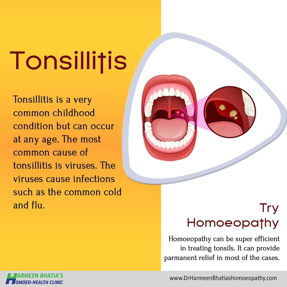 Try Homoeopathy It Can Provide Permanent Relief In Most Of The Cases ...